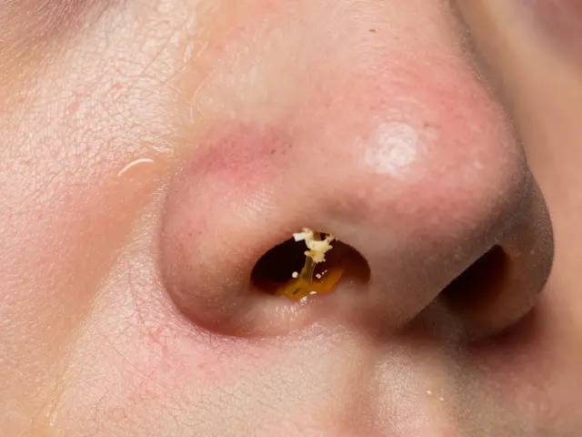 Co opravdu funguje na akné? Důkazy z dermatologie