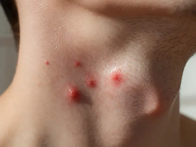 Proč se dělají pupínky po holení? Příčiny a řešení